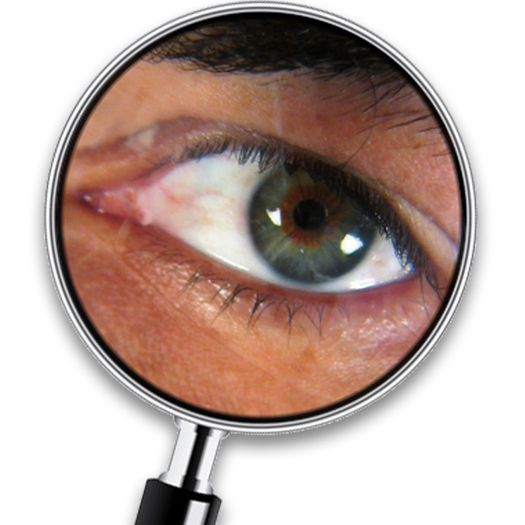 Schädlings-Diagnose ONLINE – Kammerjäger Stuttgart – AML Schädlingsbekämpfung Online-Schädlings-Bekämpfung – Kammerjäger für Stuttgart – AML Schädlingsbekämpfung